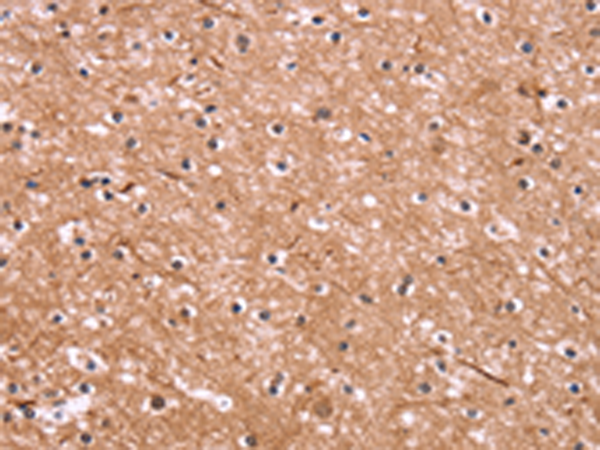 Anti-CSNK1D Rabbit Polyclonal Antibody