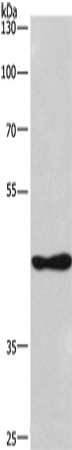 Anti-CSNK1D Rabbit Polyclonal Antibody
