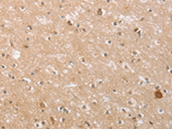 Anti-MIA2 Rabbit Polyclonal Antibody