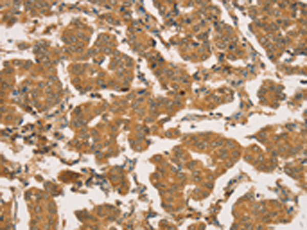 Anti-RBBP8 Rabbit Polyclonal Antibody