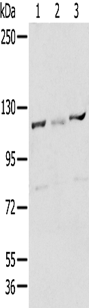 Anti-RBBP8 Rabbit Polyclonal Antibody