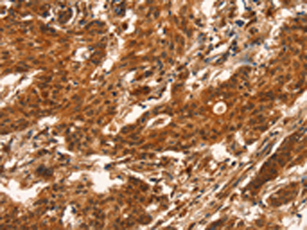 Anti-CUEDC2 Rabbit Polyclonal Antibody