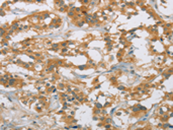 Anti-Cytochrome P450 27A1 Rabbit Polyclonal Antibody