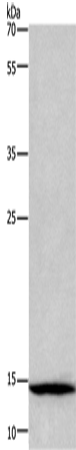 Anti-Cystatin A Rabbit Polyclonal Antibody
