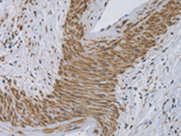 Anti-CYB5A Rabbit Polyclonal Antibody
