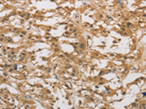 Anti-DAB2 Rabbit Polyclonal Antibody