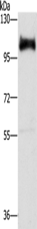Anti-DAB2 Rabbit Polyclonal Antibody