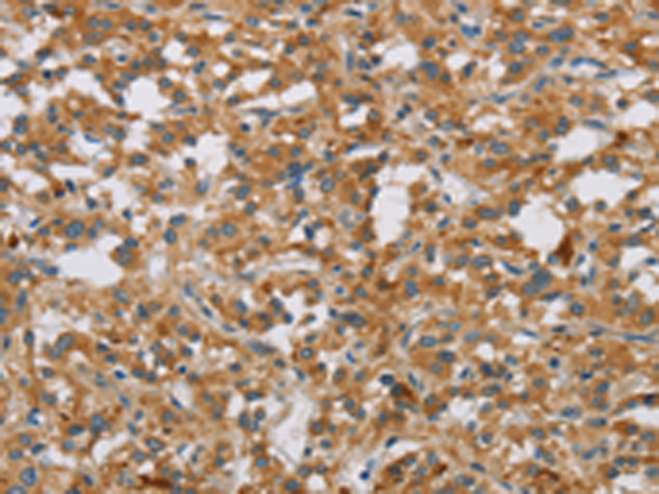 Anti-Dopamine beta Hydroxylase Rabbit Polyclonal Antibody