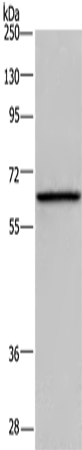 Anti-Dopamine beta Hydroxylase Rabbit Polyclonal Antibody