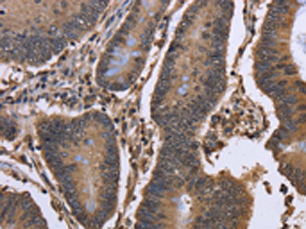 Anti-DCP1A Rabbit Polyclonal Antibody