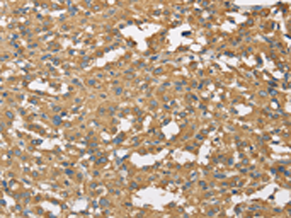 Anti-Dynactin Subunit 2 Rabbit Polyclonal Antibody