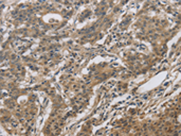 Anti-DHRS3 Rabbit Polyclonal Antibody
