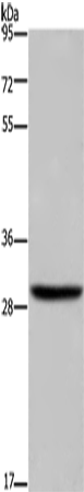 Anti-DHRS3 Rabbit Polyclonal Antibody