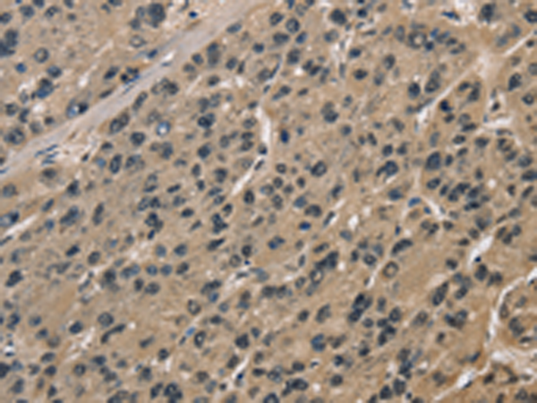 Anti-CCAR1 Rabbit Polyclonal Antibody