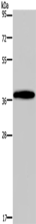 Anti-DLX4 Rabbit Polyclonal Antibody
