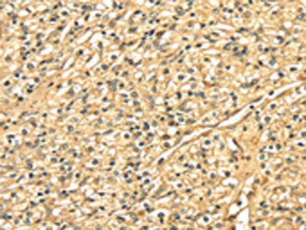 Anti-DNASE1 Rabbit Polyclonal Antibody