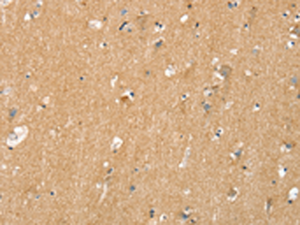 Anti-TNFRSF21 Rabbit Polyclonal Antibody