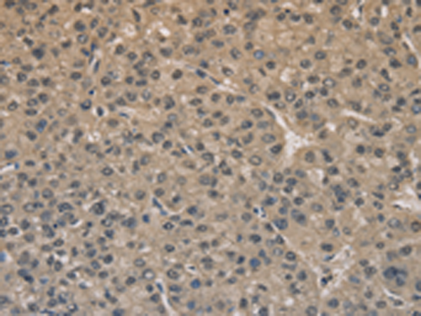 Anti-DRG1 Rabbit Polyclonal Antibody