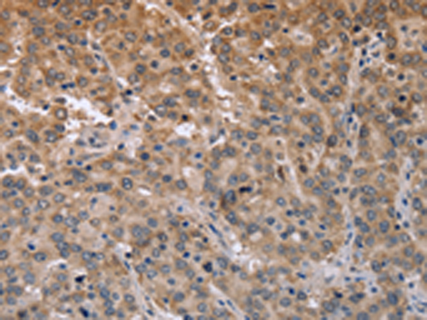 Anti-ECE1 Rabbit Polyclonal Antibody