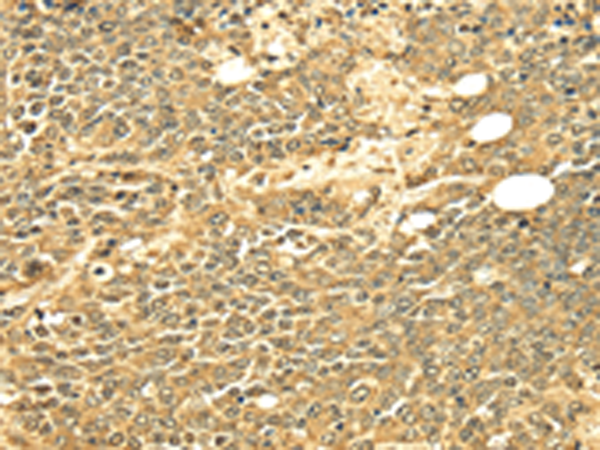 Anti-EEF1AKMT4 Rabbit Polyclonal Antibody