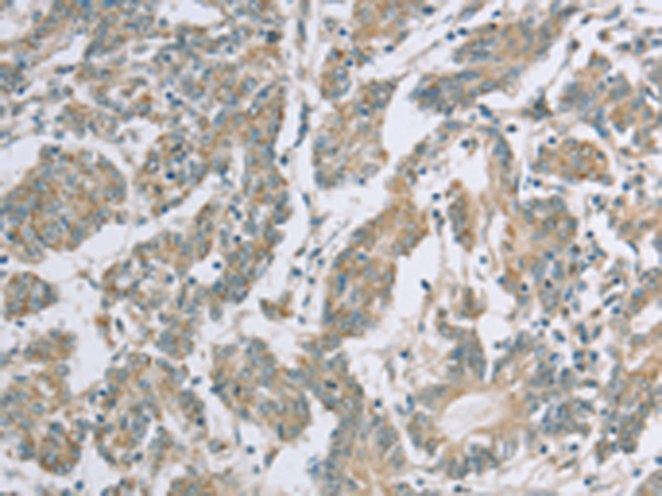 Anti-EDA2R Rabbit Polyclonal Antibody