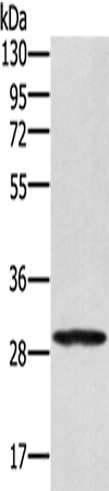 Anti-EDA2R Rabbit Polyclonal Antibody
