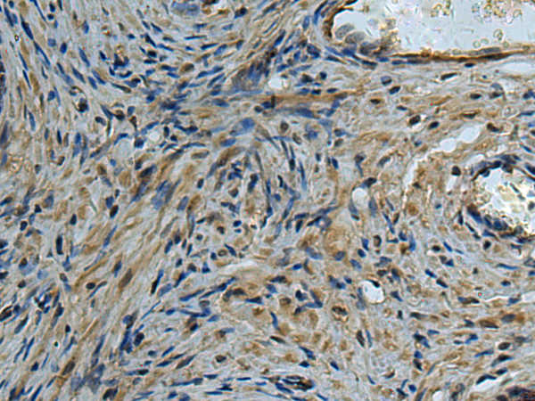 Anti-EDIL3 Rabbit Polyclonal Antibody