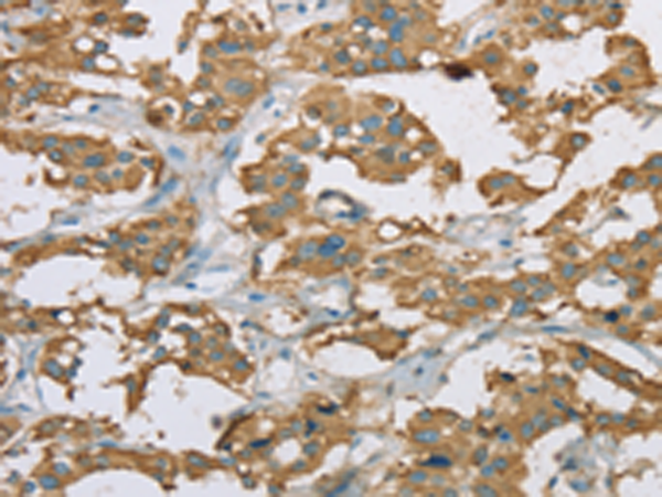 Anti-EHHADH Rabbit Polyclonal Antibody