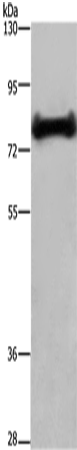 Anti-EHHADH Rabbit Polyclonal Antibody