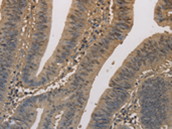 Anti-ELOVL1 Rabbit Polyclonal Antibody