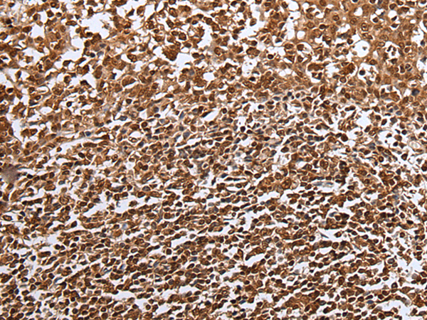 Anti-LIPG Rabbit Polyclonal Antibody