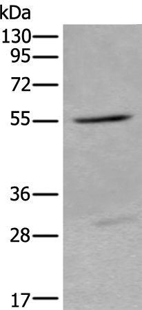 Anti-LIPG Rabbit Polyclonal Antibody
