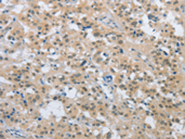 Anti-ENTPD5 Rabbit Polyclonal Antibody