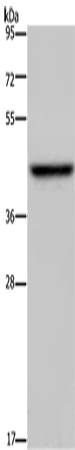 Anti-ENTPD5 Rabbit Polyclonal Antibody
