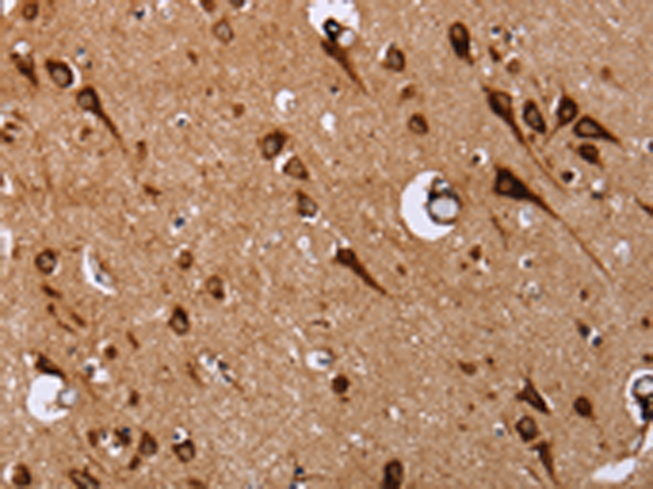 Anti-EPDR1 Rabbit Polyclonal Antibody