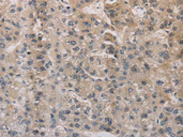 Anti-Estrogen Related Receptor gamma Rabbit Polyclonal Antibody