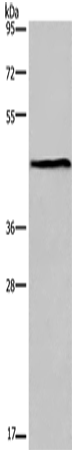 Anti-Estrogen Related Receptor gamma Rabbit Polyclonal Antibody