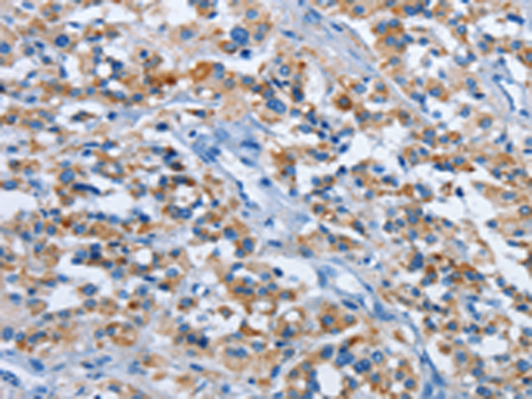 Anti-ETHE1 Rabbit Polyclonal Antibody