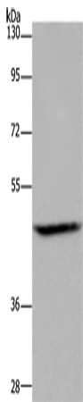Anti-ETS2 Rabbit Polyclonal Antibody