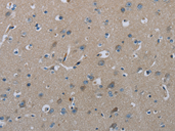 Anti-FAAH1 Rabbit Polyclonal Antibody