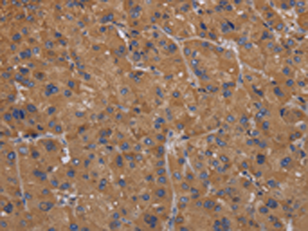 Anti-FADS1 Rabbit Polyclonal Antibody
