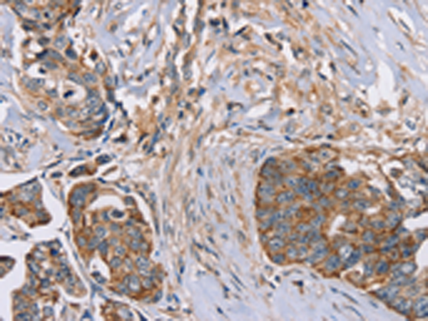 Anti-FAIM2 Rabbit Polyclonal Antibody