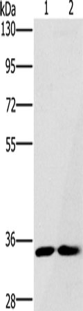 Anti-FAIM2 Rabbit Polyclonal Antibody