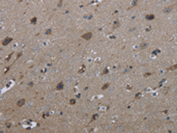 Anti-FAM89B Rabbit Polyclonal Antibody