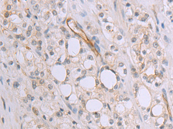 Anti-FAR2 Rabbit Polyclonal Antibody