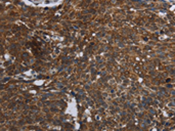 Anti-FASTKD2 Rabbit Polyclonal Antibody