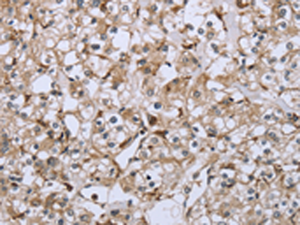 Anti-CD32B Rabbit Polyclonal Antibody