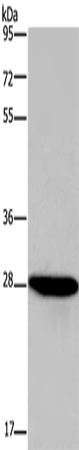 Anti-FGF17 Rabbit Polyclonal Antibody