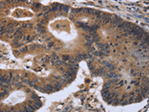 Anti-FGF21 Rabbit Polyclonal Antibody