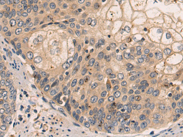 Anti-FGL2 Rabbit Polyclonal Antibody